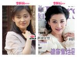 美体:下颌角整形术全过程(图)
